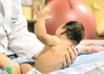Assuntos Sociais: Crianças com Zika Vírus vão receber pensão e indenização de R$50 mil