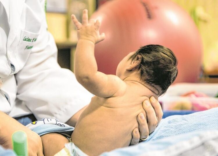Assuntos Sociais: Crianças com Zika Vírus vão receber pensão e indenização de R$50 mil